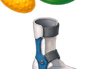 An ankle brace — the supportive equipment during recovery